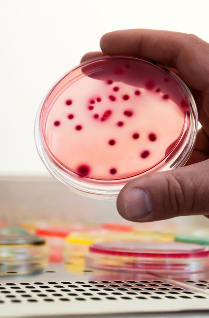 bacterial colonies culture differential selective media biotechnology health 1 LIV Hospital