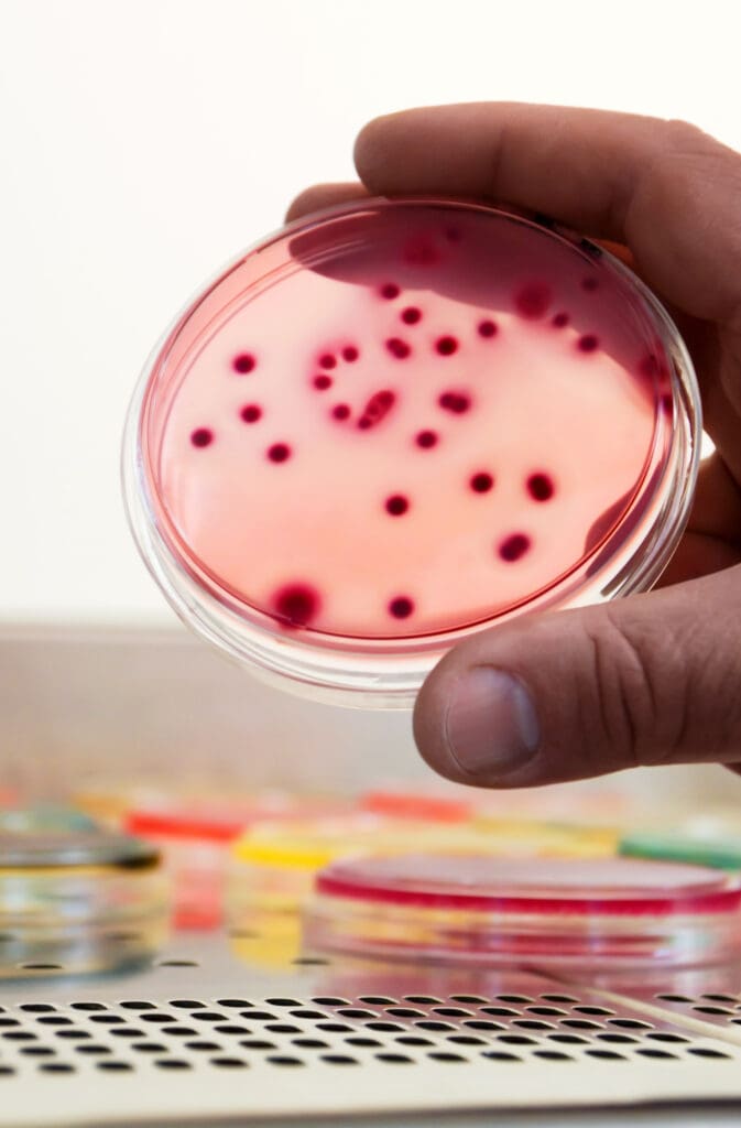 bacterial colonies culture differential selective media biotechnology health 2 LIV Hospital