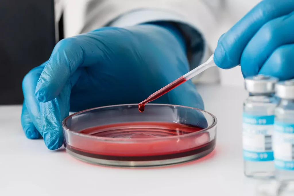 blood and platelet transfusion