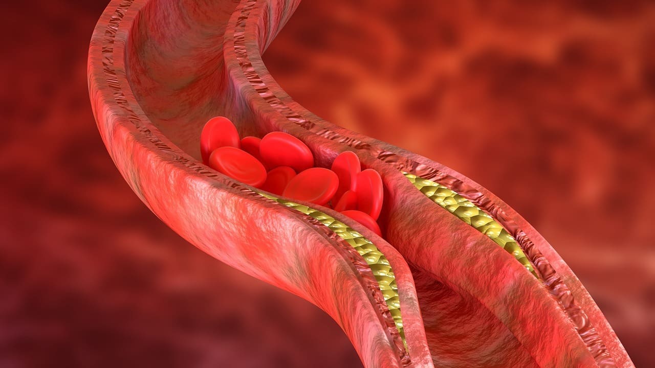 blood carried by the pulmonary arteries