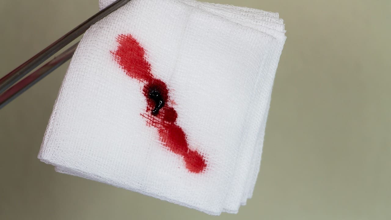 blood clots after surgery