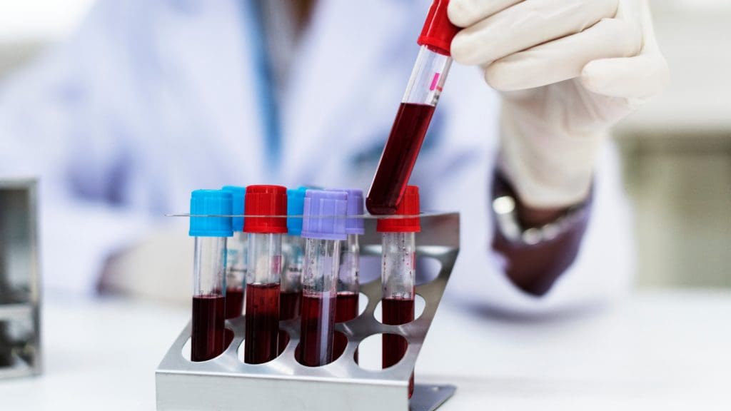 blood testing