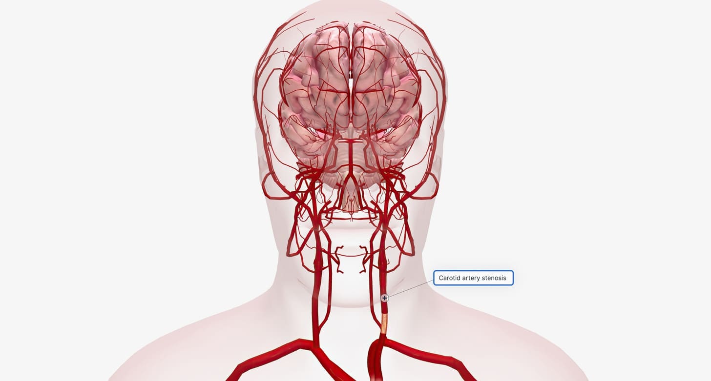 blood vessels in head