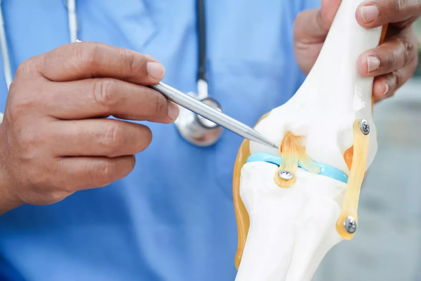 bone cement knee surgery