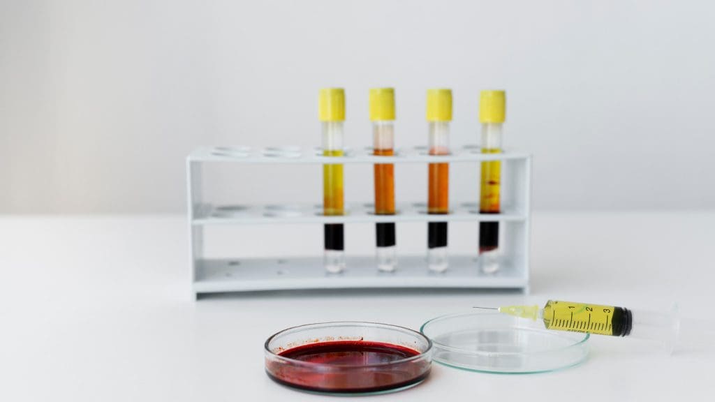 bone marrow fluid for testing