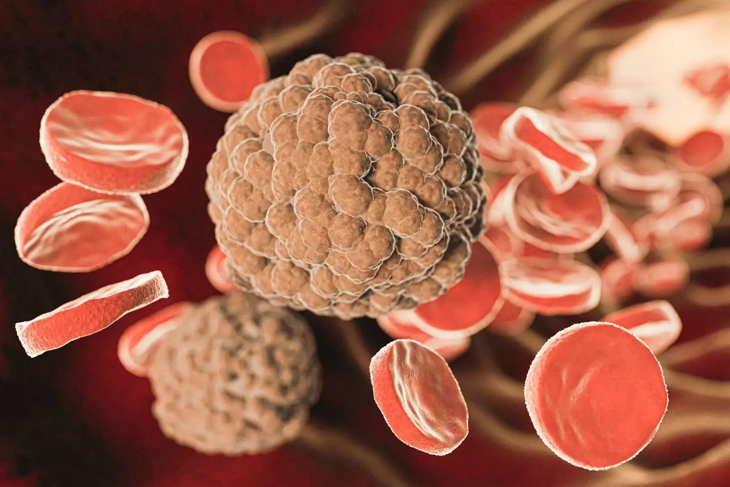 bone marrow transplant for leukemia