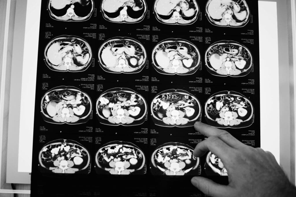 brain CT scan