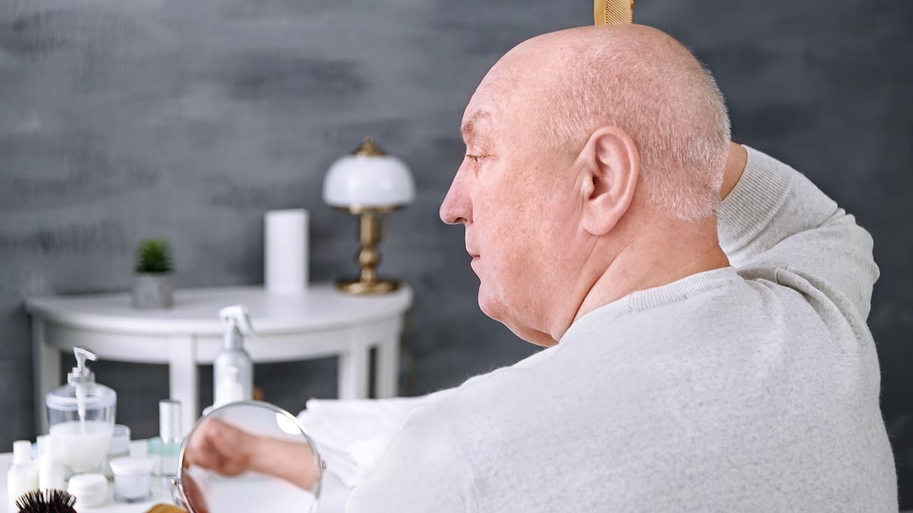 brain cancer hair loss