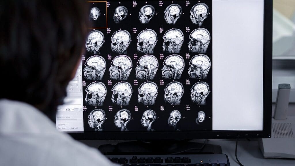 brain imaging techniques