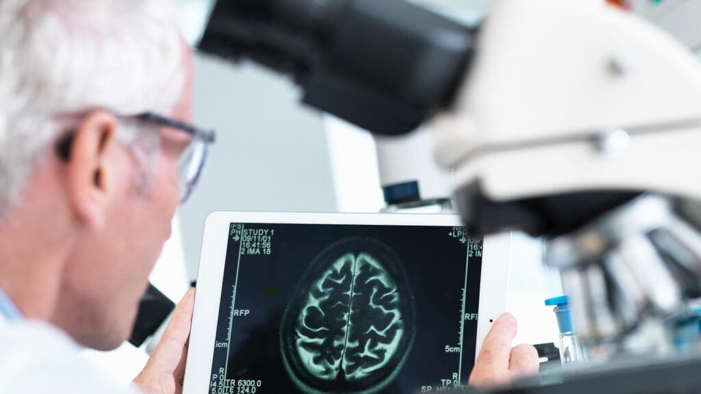 brain stem tumor types