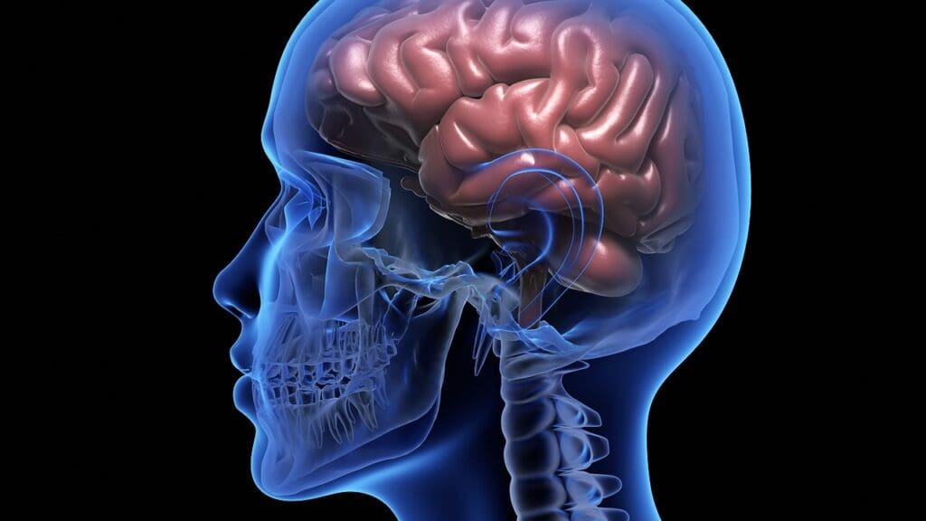 brain swelling cancer