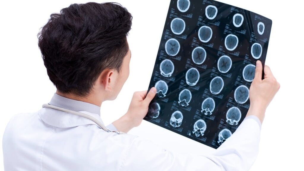 brain swelling factors