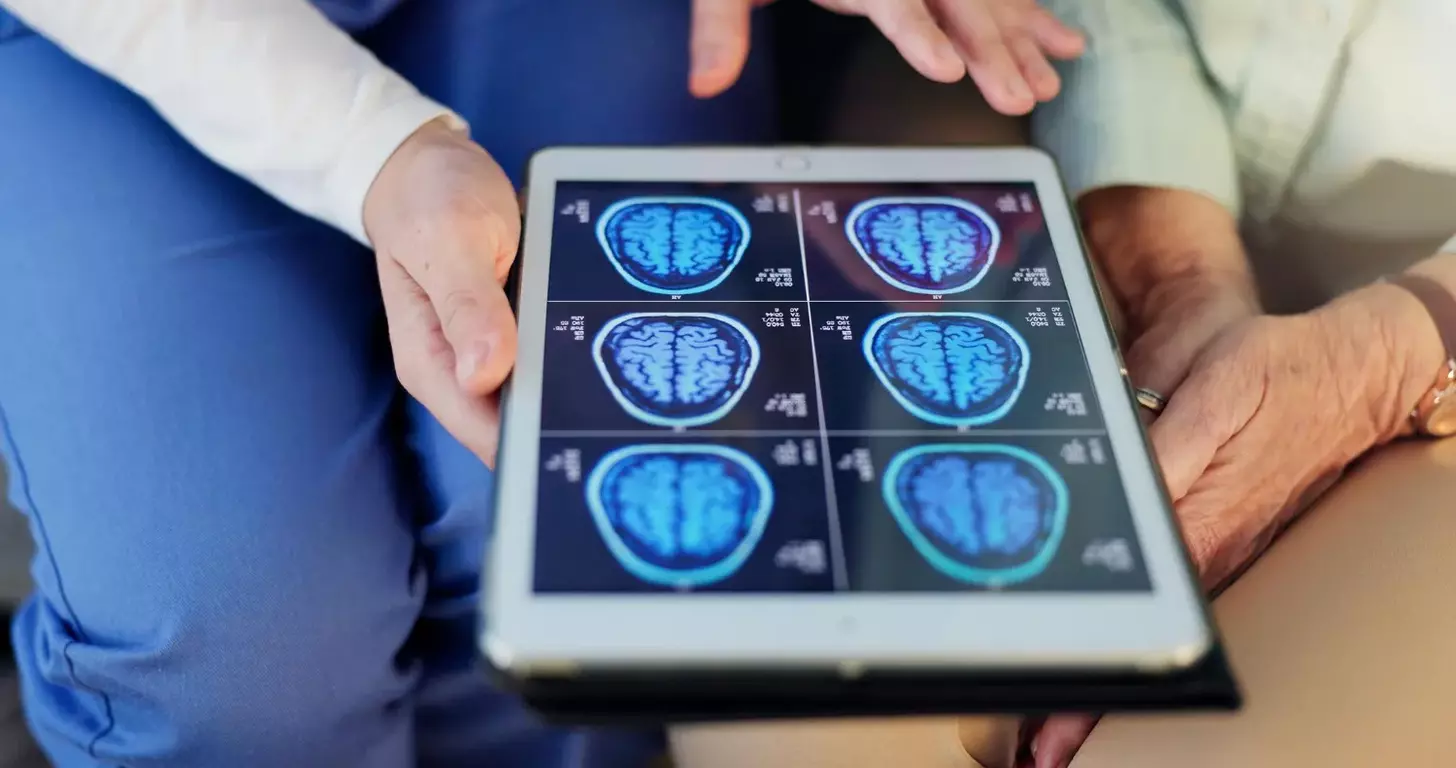 brain tumor affecting speech and memory