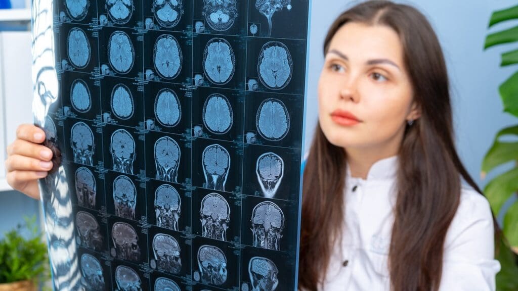 brain tumor balance disorders brain tumor balance disorders