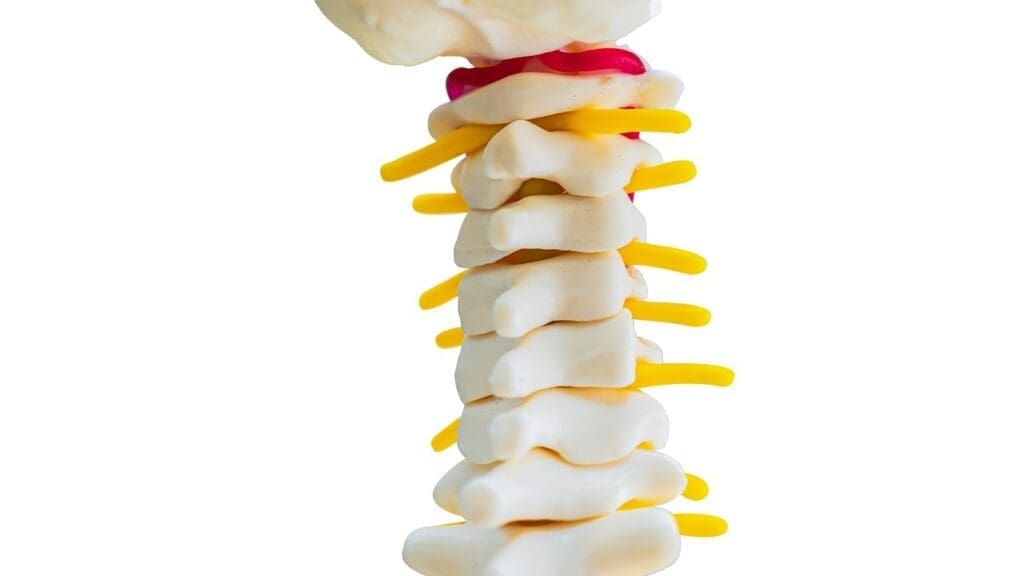 bulging disc causing sciatica