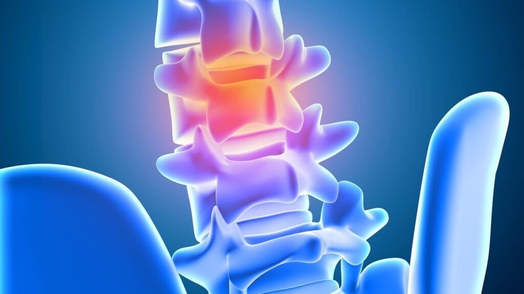 bulging disc sciatic nerve