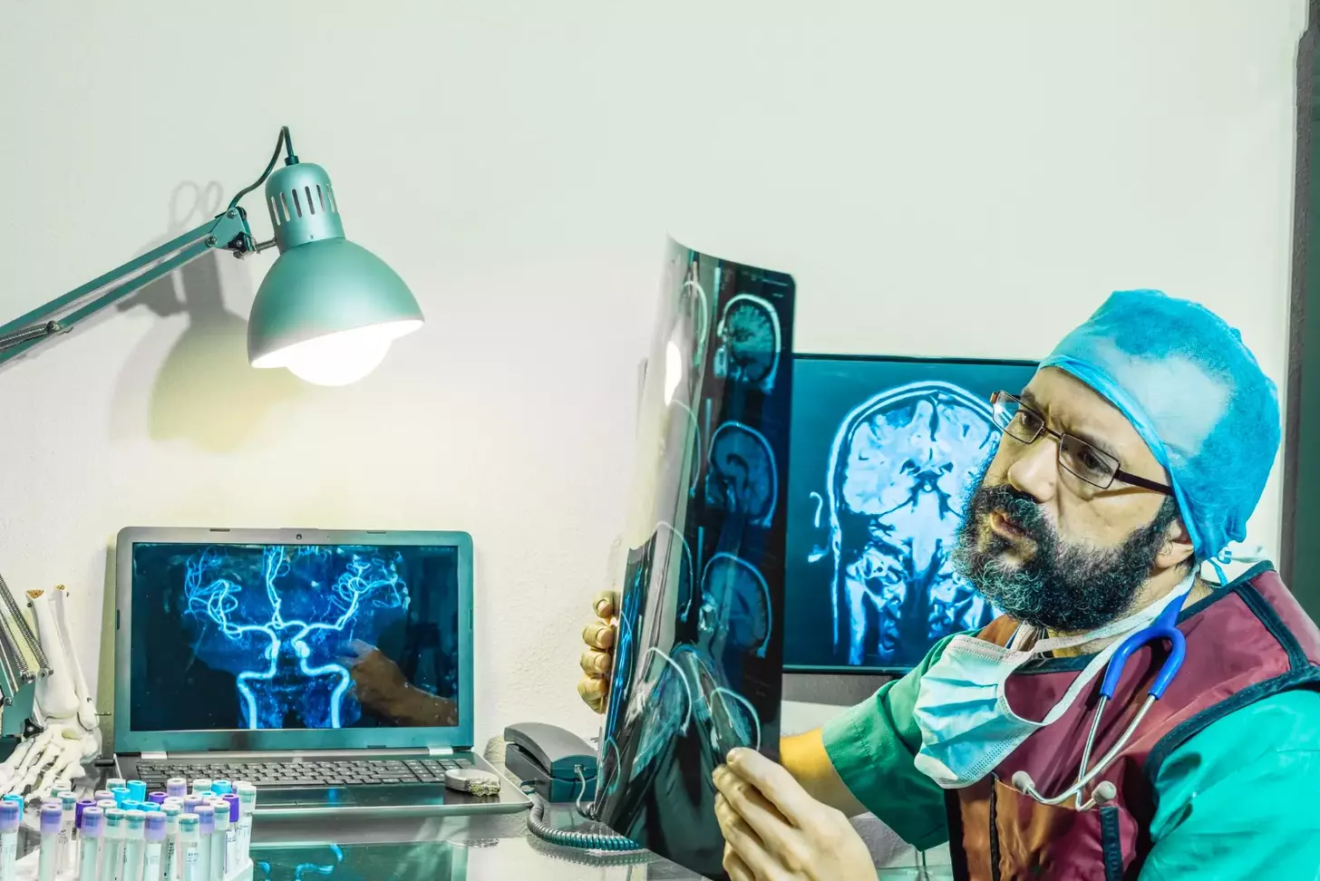 bulging eye brain tumor