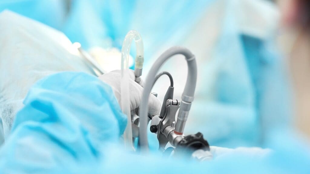 7 Essential Tips for Catheter and Recovery After Robotic Prostatectomy