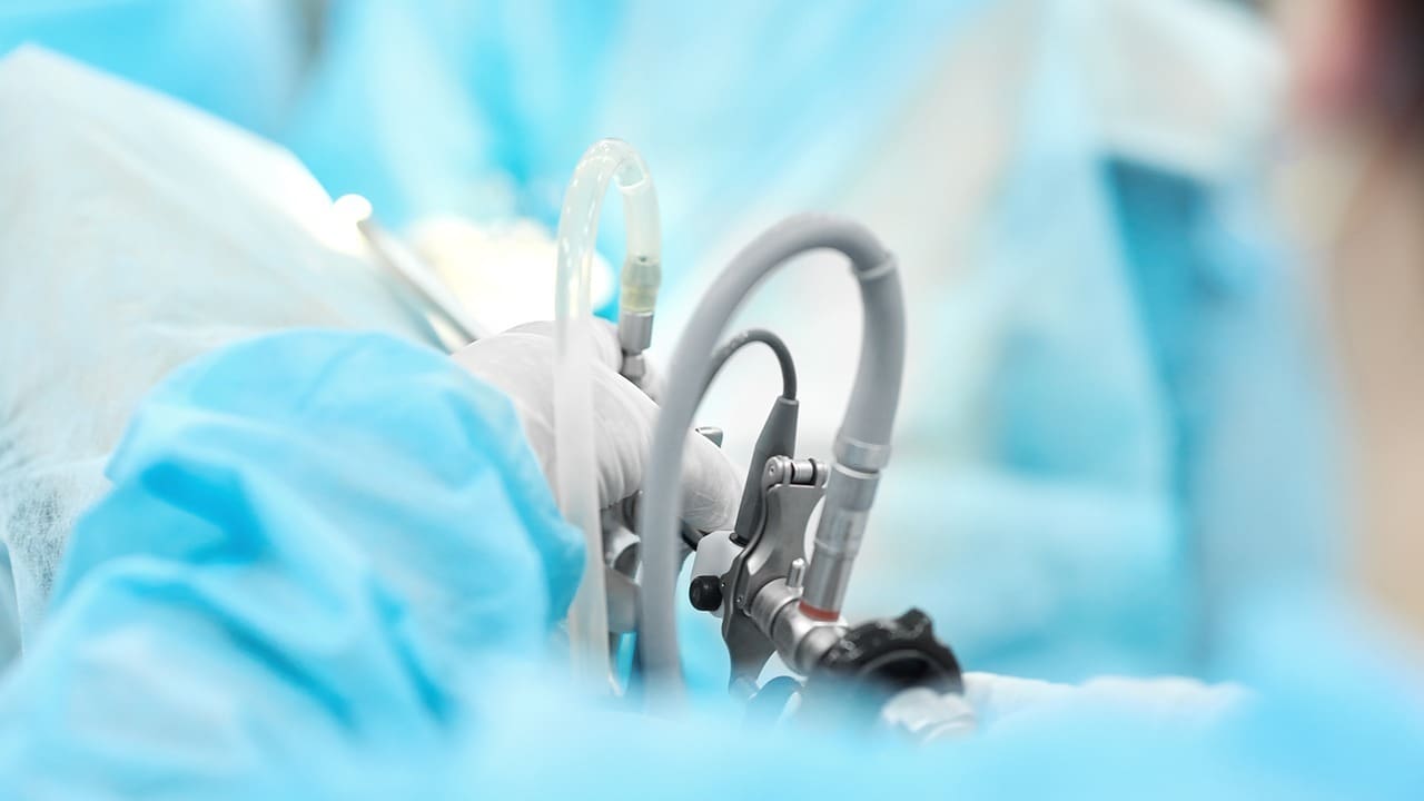 catheter after prostate surgery