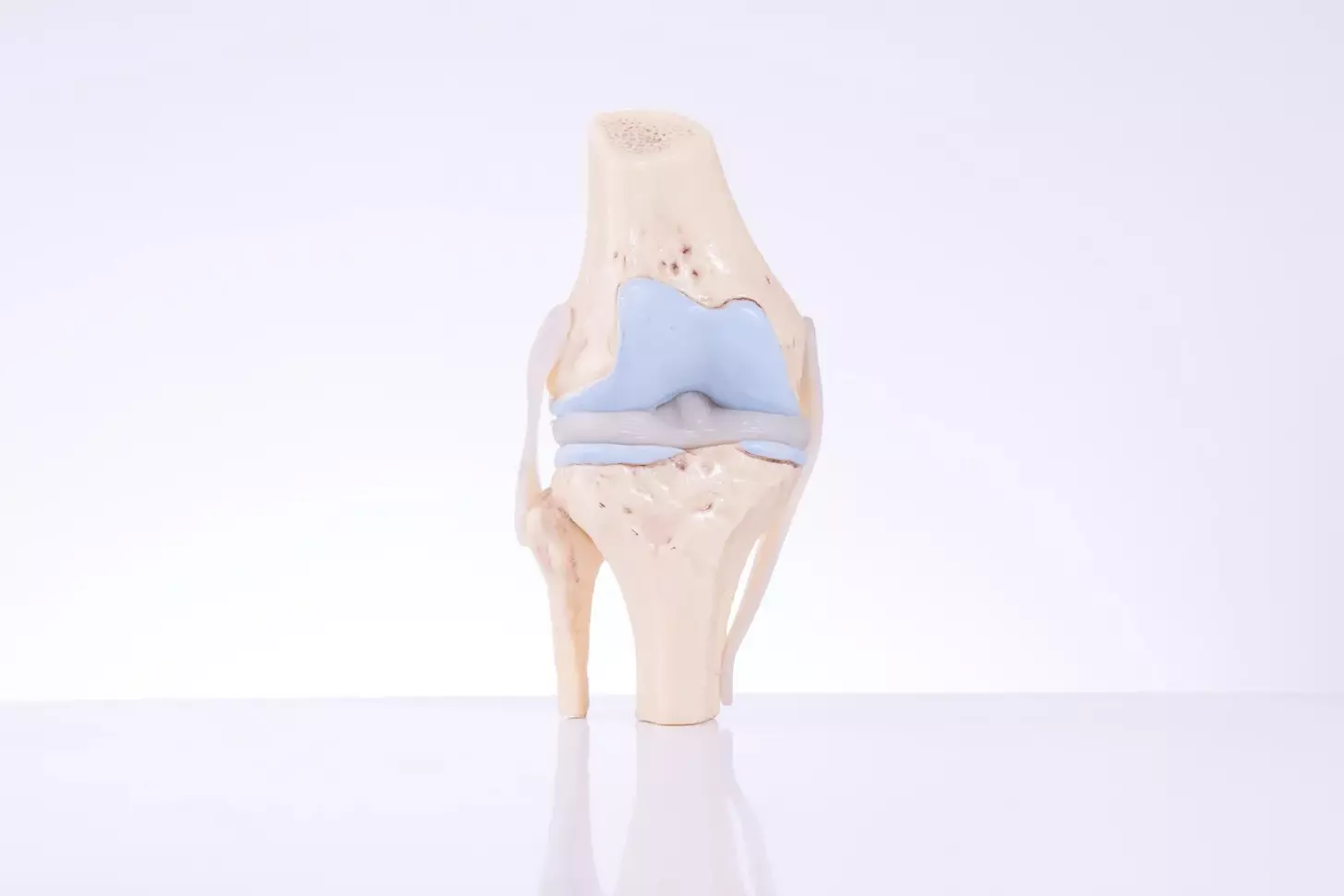 cemented knee replacement