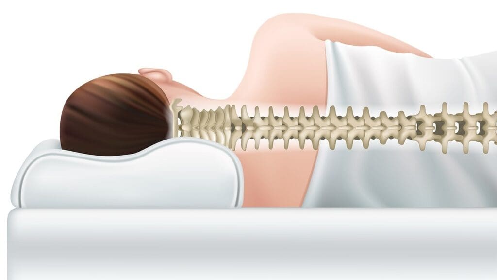 central disk protrusion