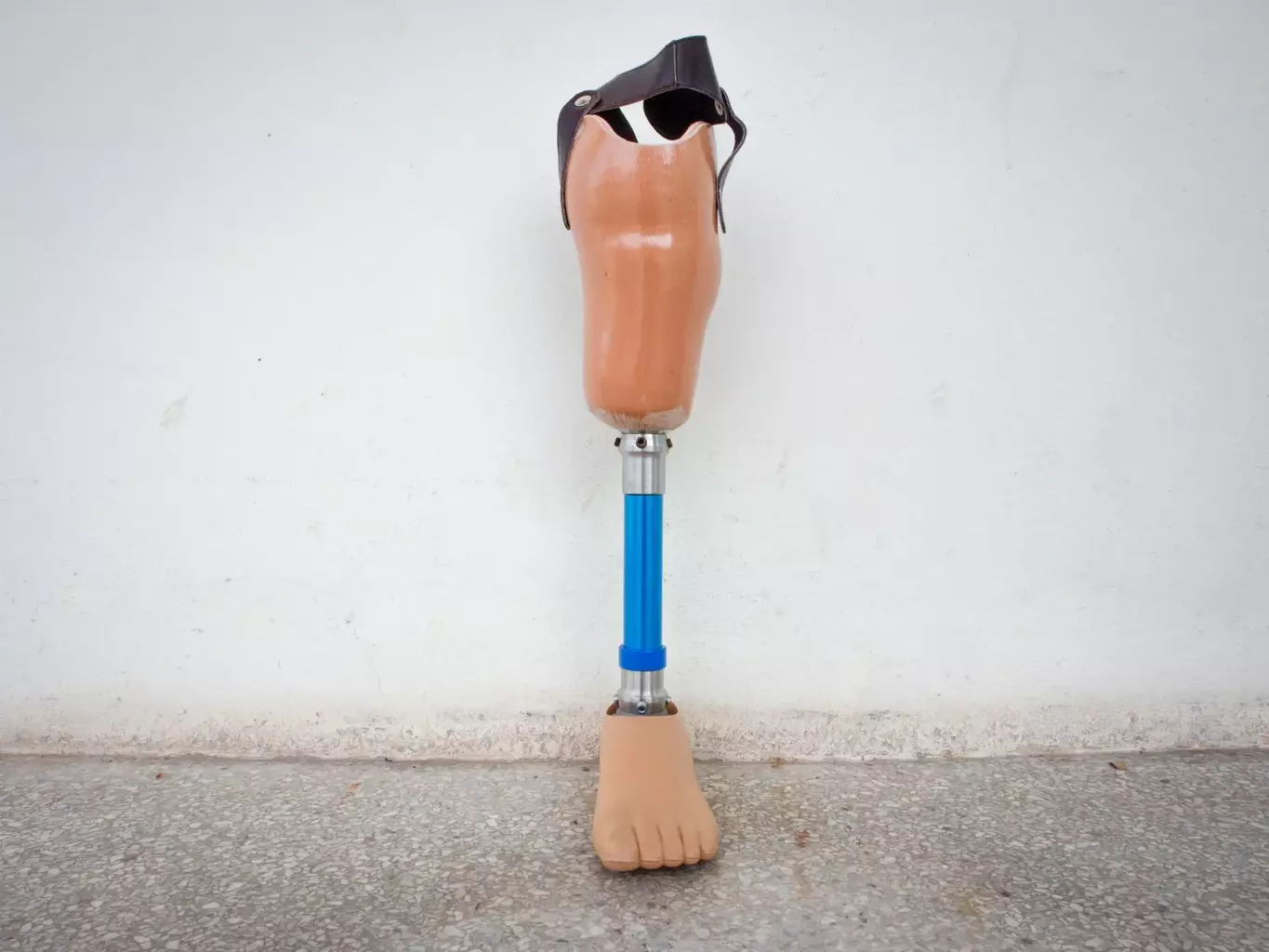 ceramic knee prosthesis