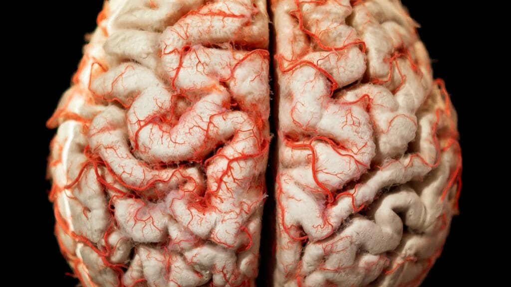 What is a Cerebellar Cyst and How is it Treated? 1 What is a Cerebellar Cyst and How is it Treated?