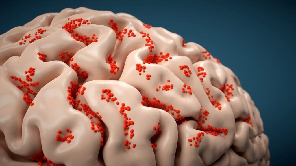 cerebrospinal fluid circulation cerebrospinal fluid circulation