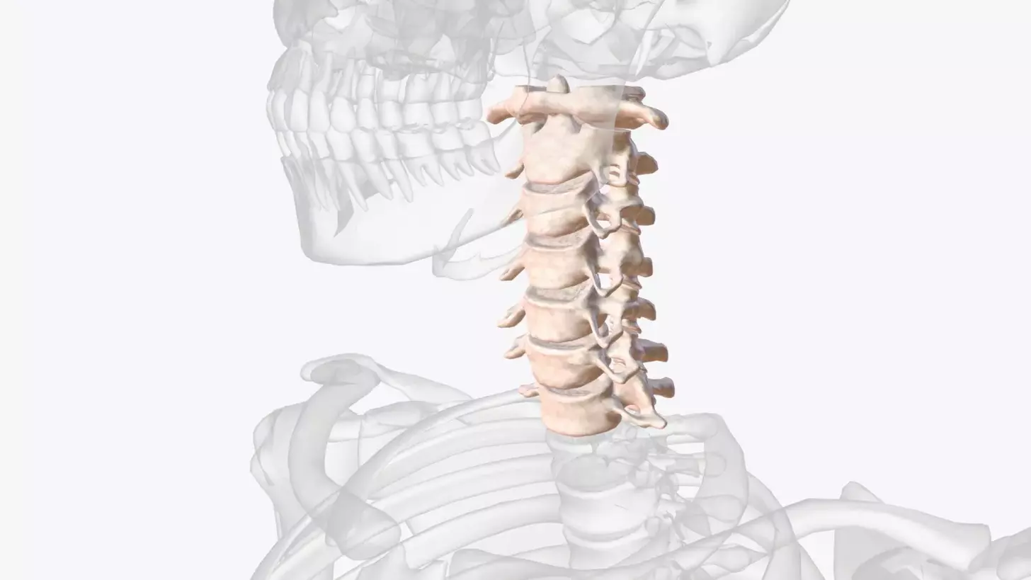 cervical neck fusion