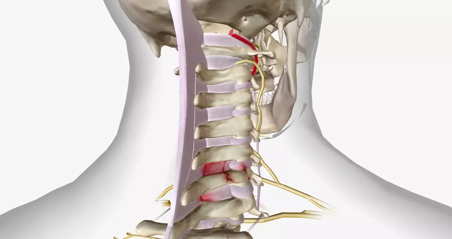 cervical spinal fusion surgery