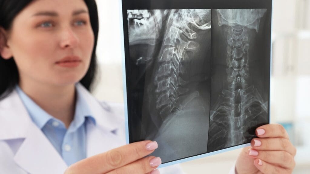 cervical spine surgery complications