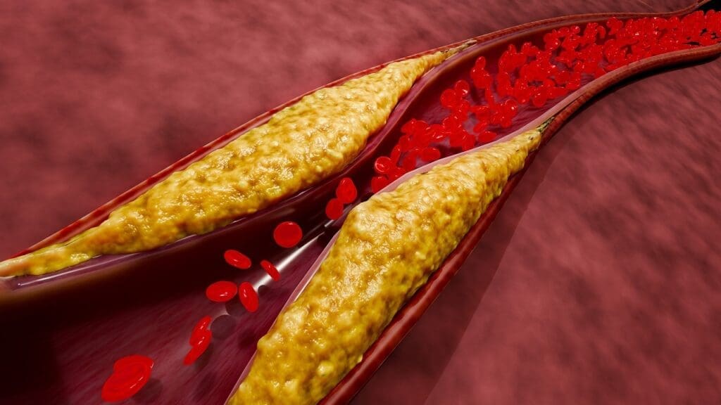 chew aspirin heart attack chew aspirin heart attack