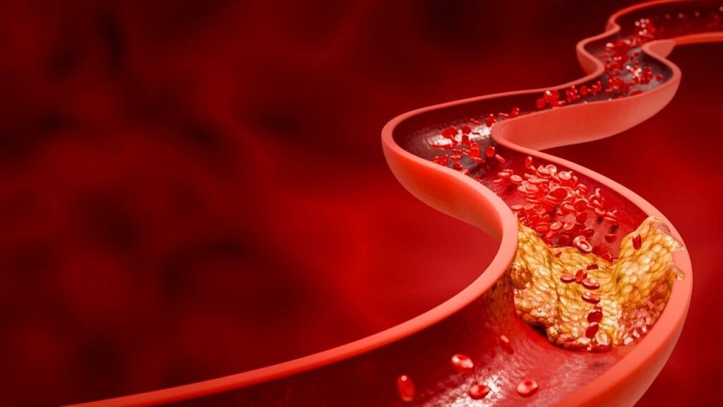 chew aspirin heart attack chew aspirin heart attack