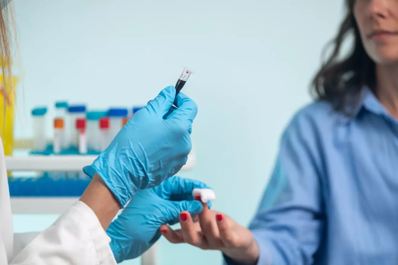 chimeric antigen receptor