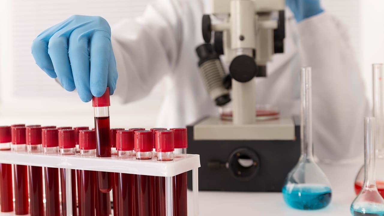 cord blood testing