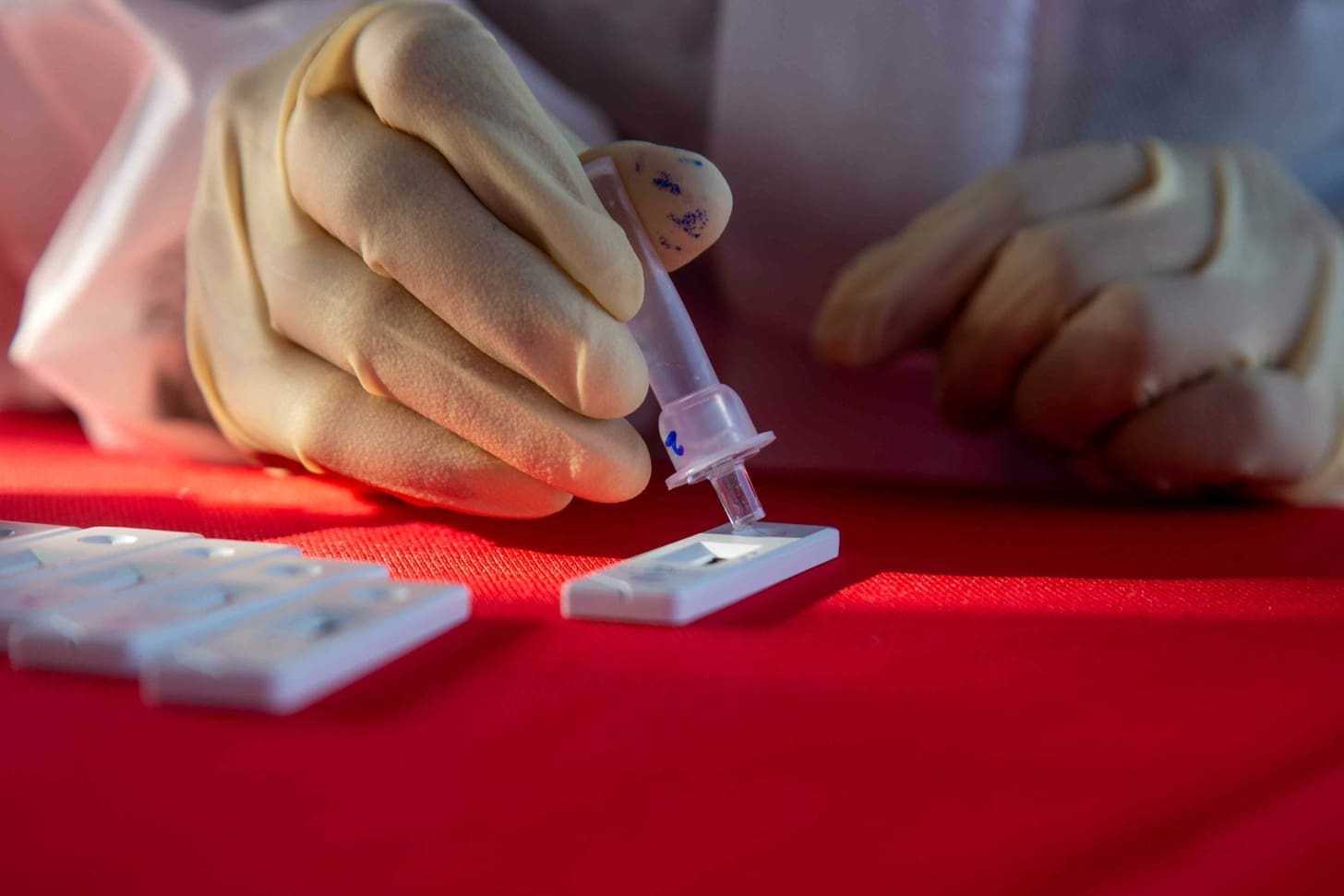 Cord Tissue Banking vs Cord Blood: 5 Key Differences and Benefits