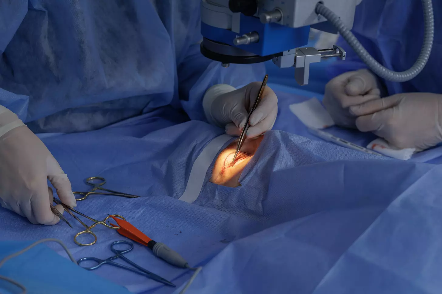 coronary artery bypass graft indications