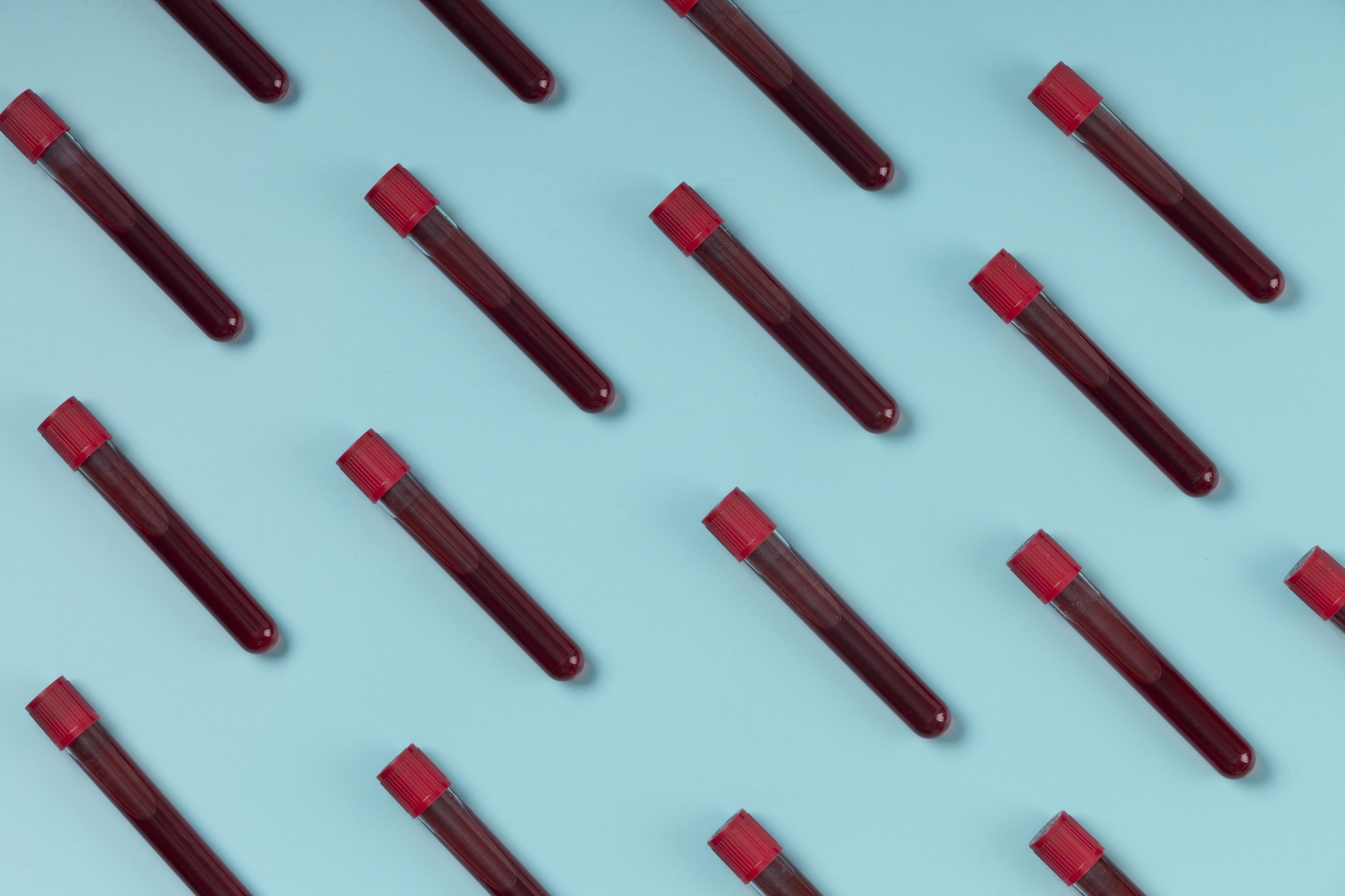 Does thalassemia get worse as you age