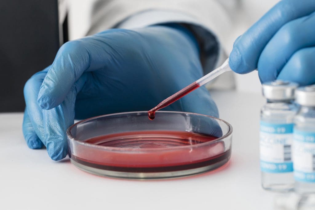 Common Drugs That Cause Hematologic Disorders and Anemia 1 Drugs That Cause Hematologic Disorders