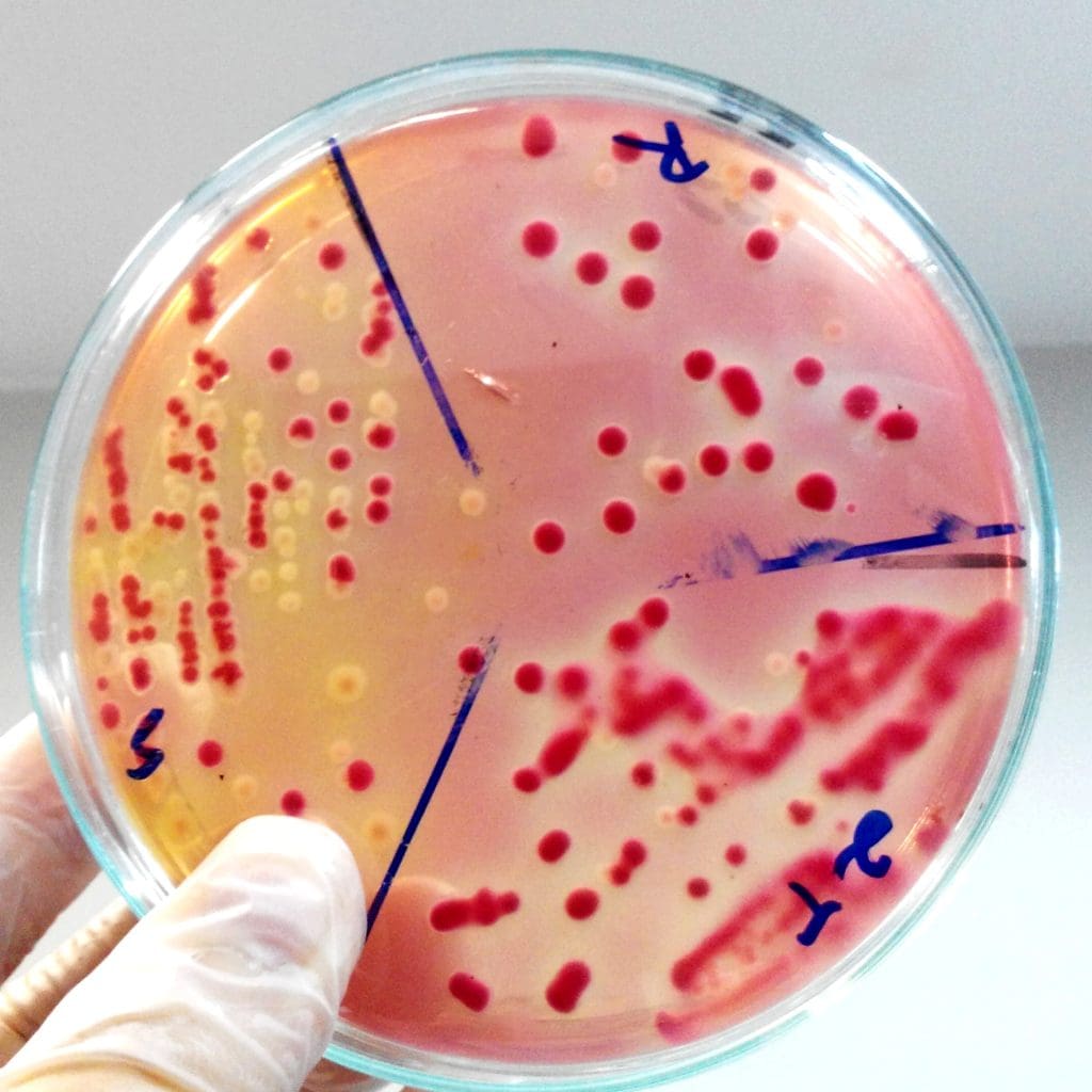 cropped hand scientist holding agar plate with blood laboratory LIV Hospital