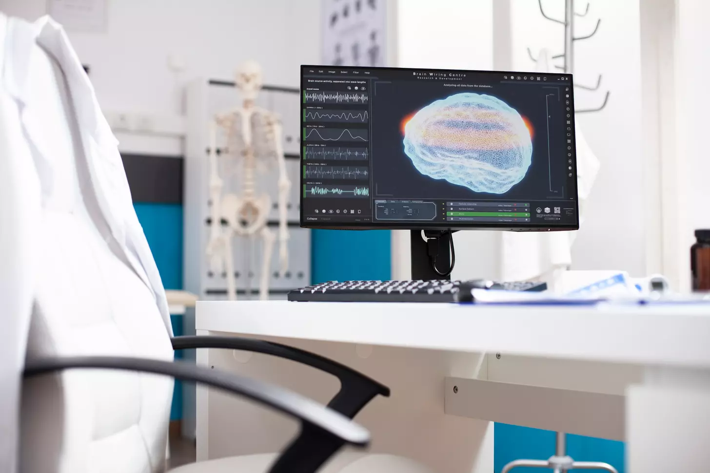 decompression surgery for arnold chiari malformation