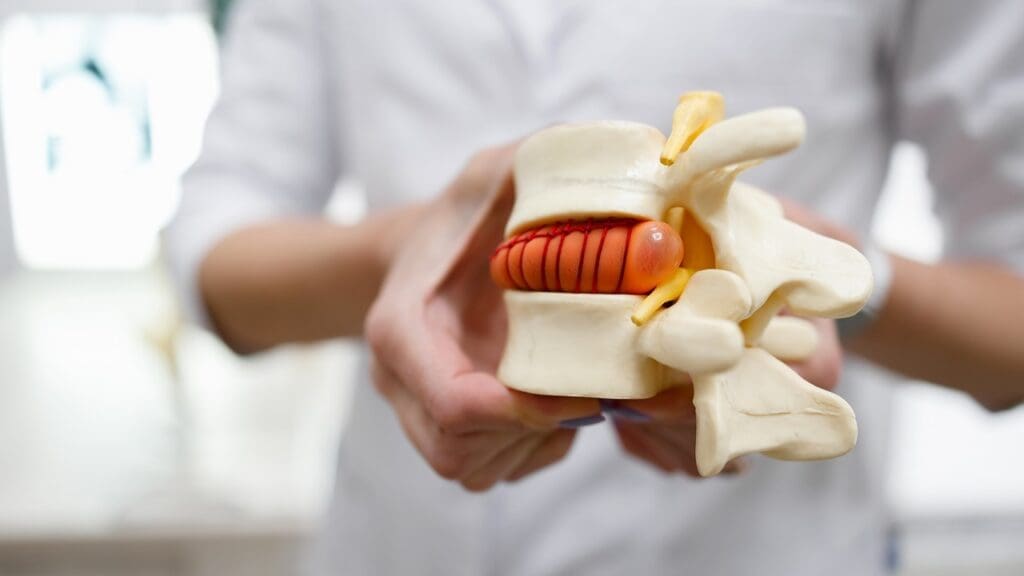 disc herniation stages