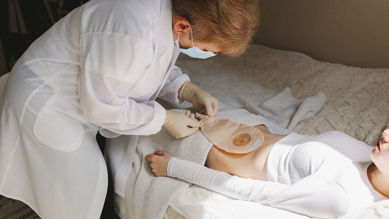 do you need a bag after prostate removal