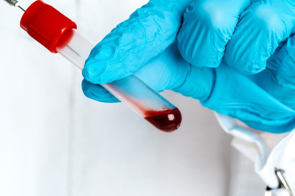 Which Blood Diseases Have No Cure? Understanding Incurable Blood Disorders 1 Incurable Blood Disorders