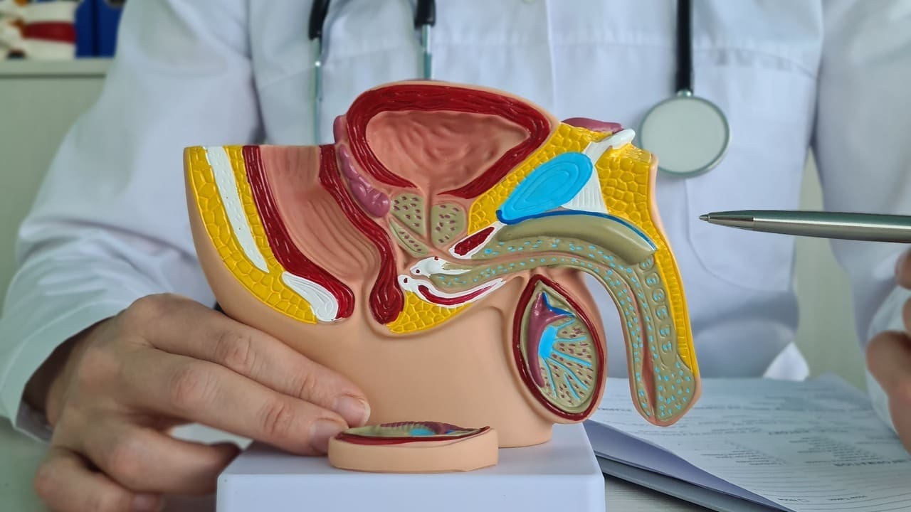 does prostate removal cause infertility