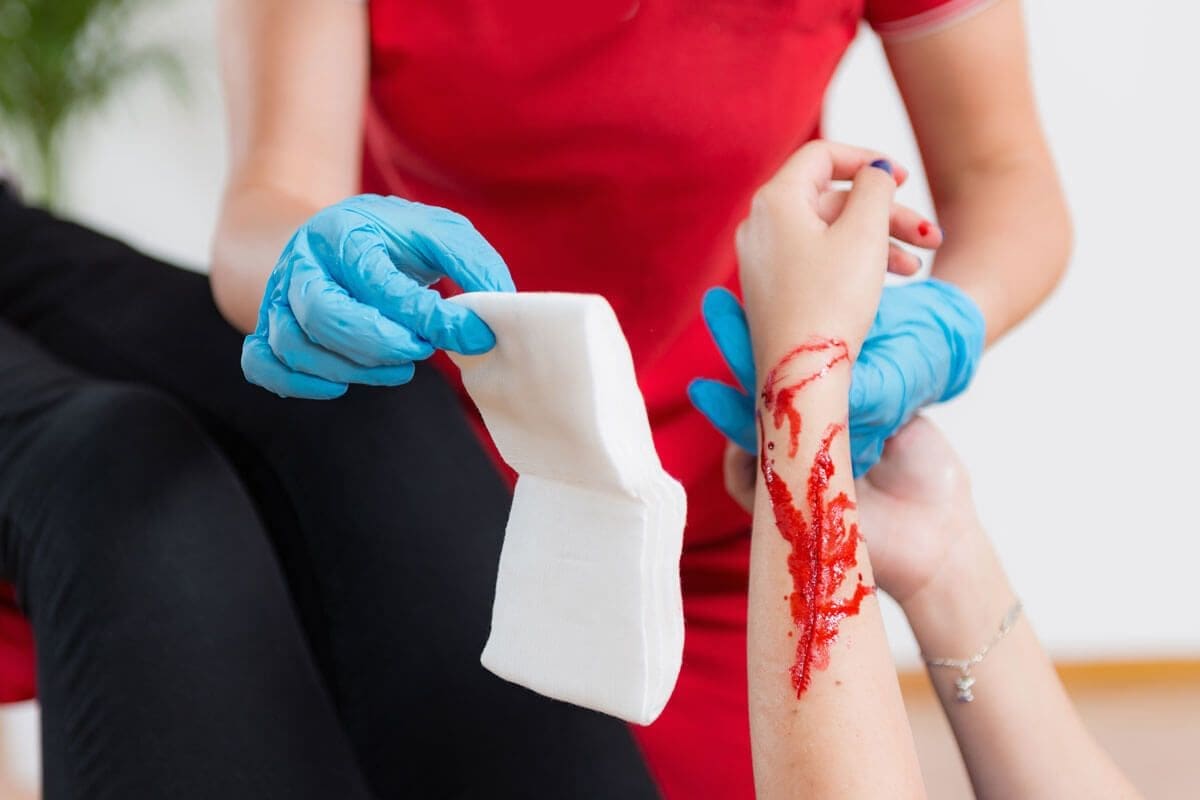 Thrombocytopenia: Crucial Bleeding Risk Level