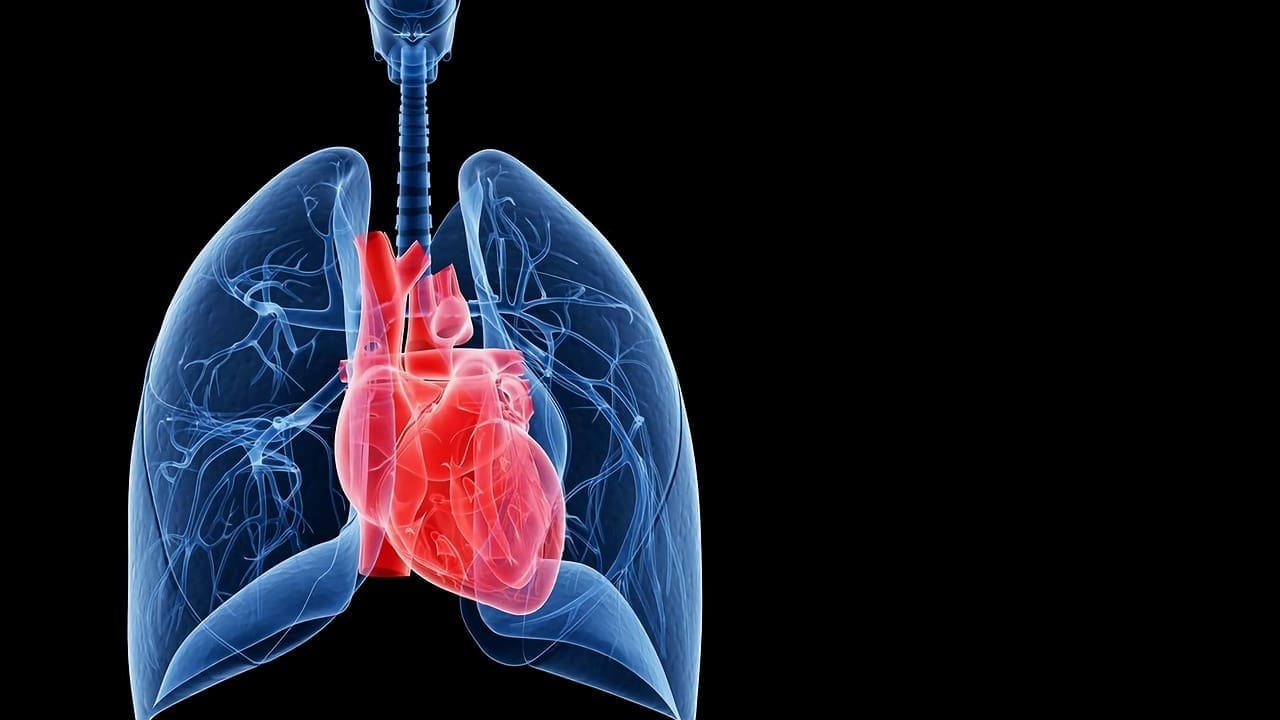 ectasia of thoracic aorta