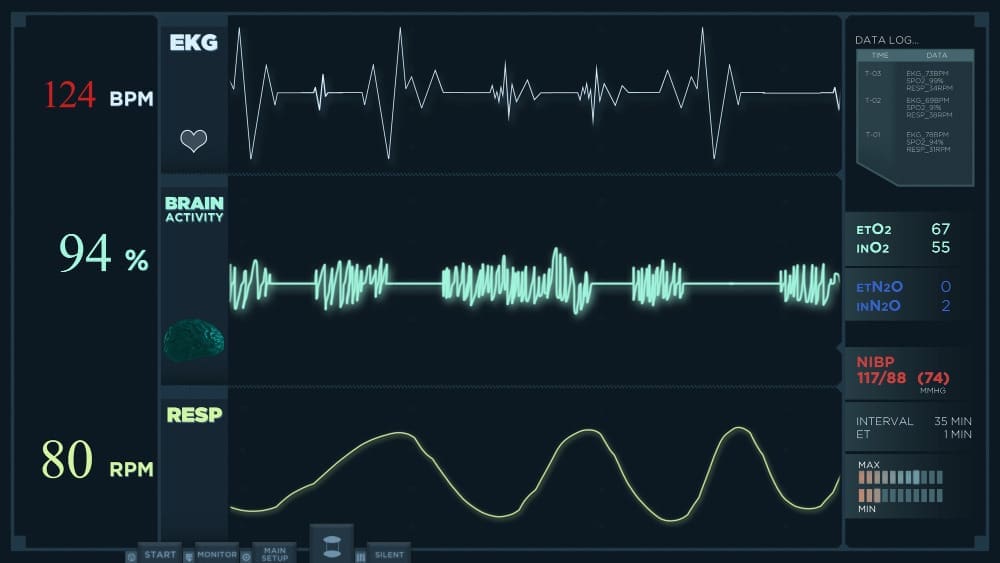ekg