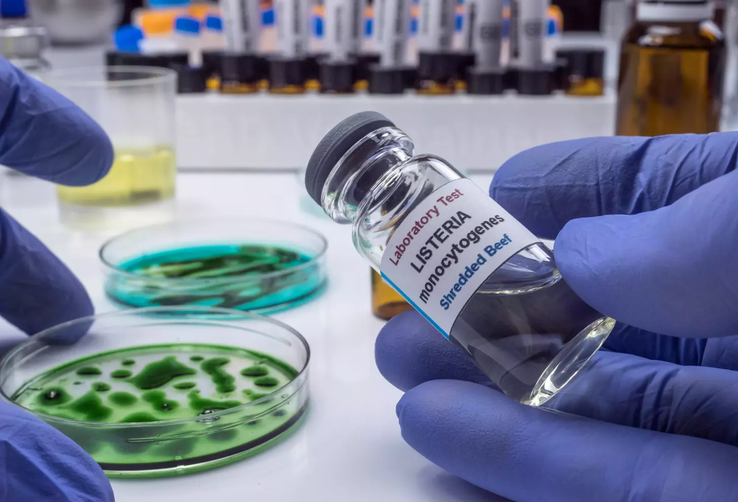 gene therapy products