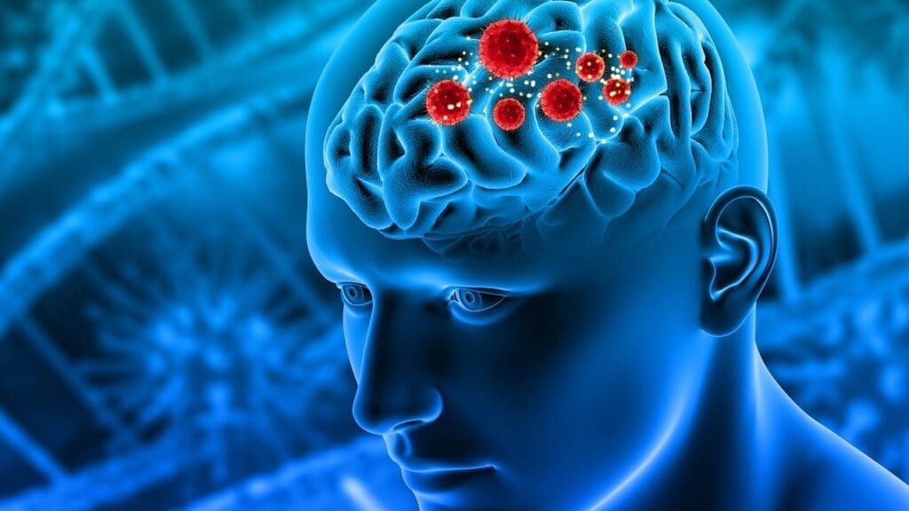 hardening of the arteries in the brain symptoms